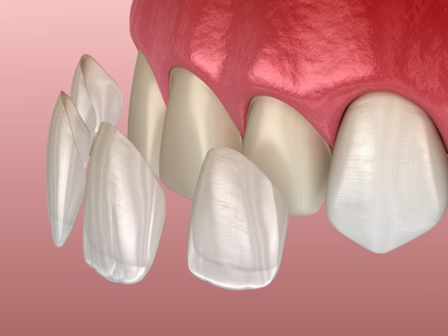 Presenting a $30,000 Smile Makeover Without Losing the Patient on Price